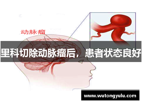里科切除动脉瘤后，患者状态良好